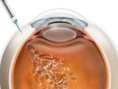 Lucentis para tratamento oftamológico