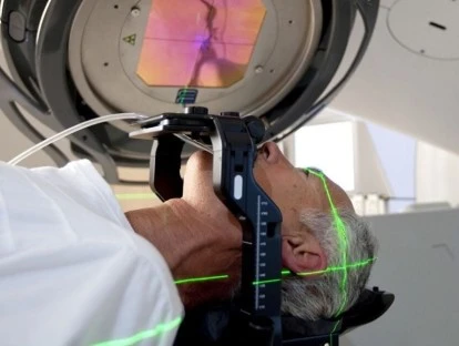 Radiocirurgia Gamma Knife: plano de saúde deve cobrir o procedimento? Veja!