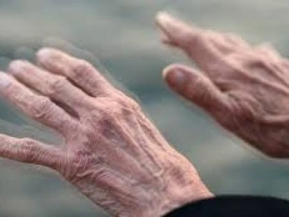 Negativa de cobertura do convênio para cirurgia de Parkinson é revertida na Justiça