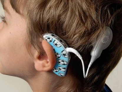 Implante coclear: plano de saúde deve cobrir todo tratamento