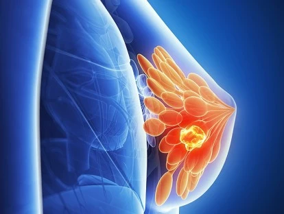 Ibrance - Palbociclib