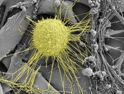 Plano de saúde deve fornecer Dabrafenibe e Tramatinibe 