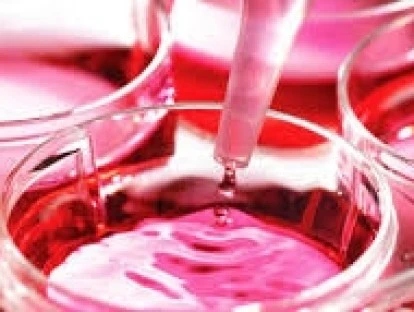 Transplante Autólogo de Células Tronco