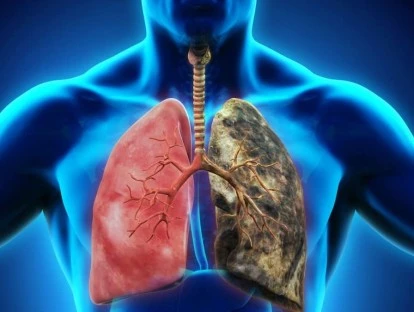 Tagrisso - Plano de saúde deve fornecer medicamento a paciente