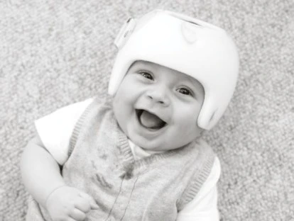 Ortese craniana para braquicefalia posicional