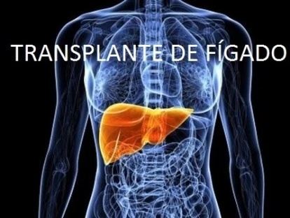 Transplante de fígado