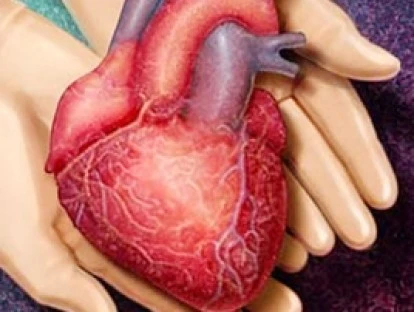 Transplante cardíaco