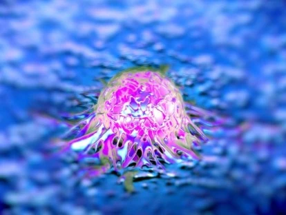 Plano de saúde é condenado a custear radioterapia por IMRT