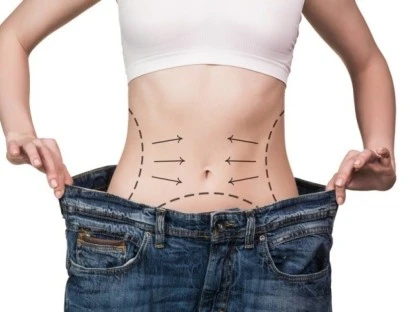 Justiça decide que cirurgia bariátrica deve ser custeada pelo plano de saúde