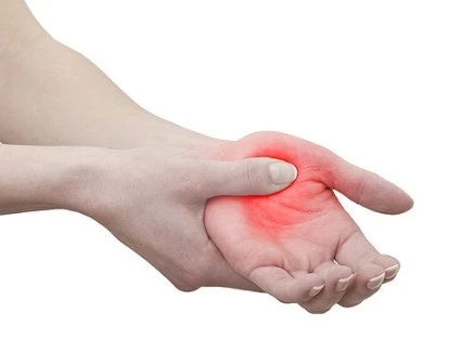 Medicamento Xeljanz (Citrato de Tofacitinibe)