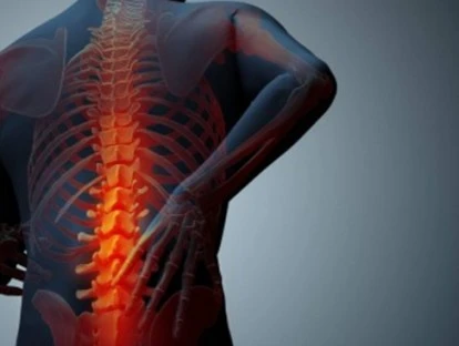 Kyprolis (Carfilzomib)