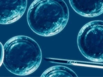 Transplante autólogo de medula óssea pelo plano de saúde