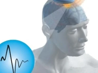 EMTr (Estimulação Magnética Transcraniana Repetitiva)