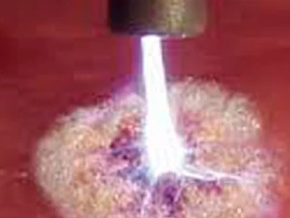 Exame de endoscopia com plasma de argônio deve ser coberto por plano de saúde