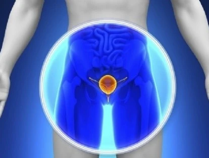 Plano de saúde deve custear método robótico HIFU 