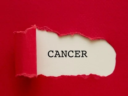  Radioterapia pelo Sistema Calypso deve ser paga pelo plano de saúde