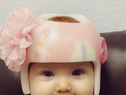 Plano de saúde é condenado a custear órtese craniana 