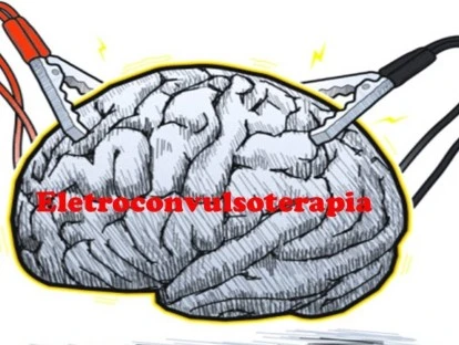 Eletroconvulsoterapia