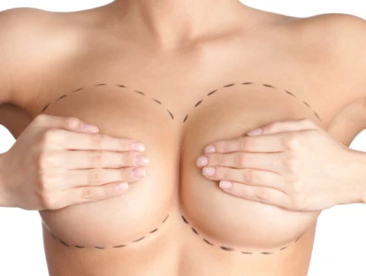  Plano de saúde deve cobrir cirurgia para corrigir assimetria mamária e retirada de nódulo