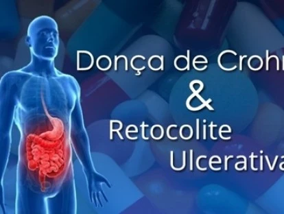 SUS deve fornecer medicamento Entyvio - Vedolizumabe