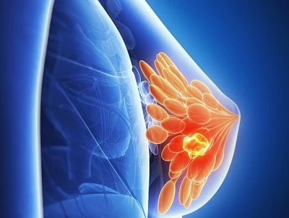 Medicamento Ibrance (Palbociclib)