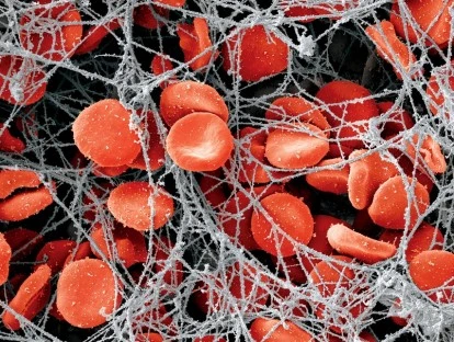 Plano de saúde deve fornecer Osimertinibe - Tagrisso para tratar câncer de pulmão