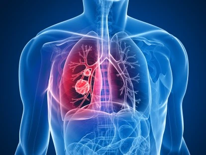 Crizotinibe (Xalkori)