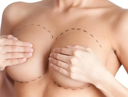 Mamoplastia para tratar gigantomastia: plano de saúde é condenado a custear cirurgia