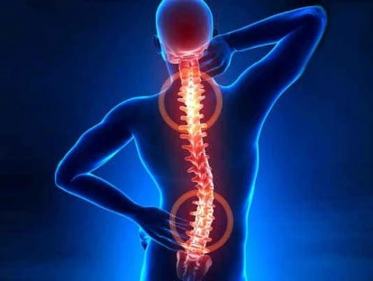 Plano de saúde deve custear cirurgia de Descompressão Percutânea de Disco por Laser 