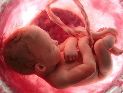 Plano de saúde deve pagar ablação vascular por via endoscópica da placenta