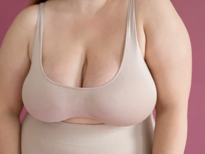 Mamoplastia redutora pós-bariátrica pelo plano de saúde: como obter cirurgia para diminuir mamas