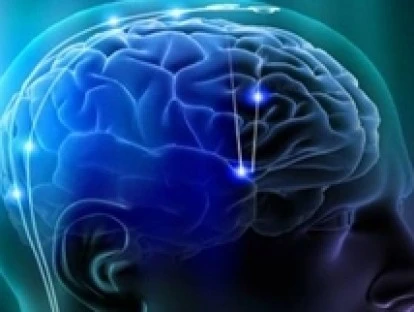 Estimulação magnética transcraniana