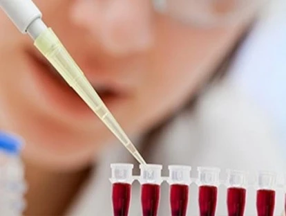 Transplante de medula óssea haploidêntico