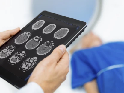 Angiotomografia pelo plano de saúde: conheça seu direito