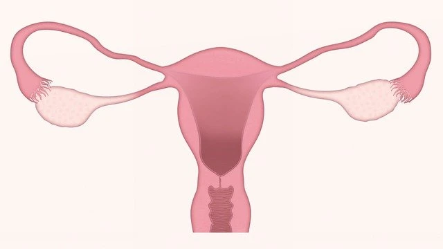 Embolização uterina: plano de saúde deve cobrir? Entenda quando a negativa é abusiva