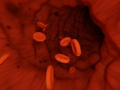 Nplate (romiplostim): deve ser fornecido pelo plano de saúde? Veja!