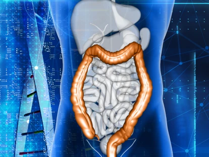 Plano de saúde deve cobrir o pembrolizumabe para o tratamento do câncer colorretal