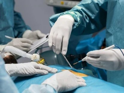 Ablação percutânea de tumor pelo plano de saúde: saiba como realizar através da Justiça