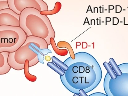 SUS e plano de saúde devem fornecer nivolumabe, decide Justiça