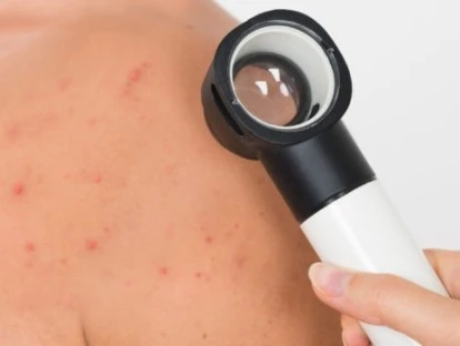 Plano de saúde deve fornecer Nivolumabe, decide Justiça