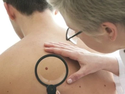 Ipilimumabe - Plano de saúde é condenado a fornecer medicamento