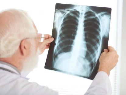 Pacientes com doença pulmonar obstrutiva crônica podem usar o FGTS para o tratamento