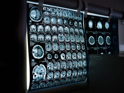 Plano de saúde deve pagar PET-CT para tumor neuroendócrino