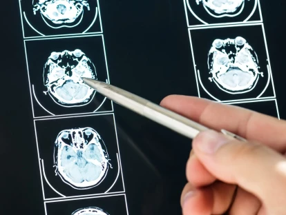 Plano de saúde deve cobrir o radiofármaco Trodat para o diagnóstico da Doença de Parkinson