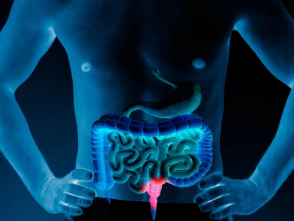 Lonsurf e bevacizumabe para câncer colorretal metastático pelo plano de saúde: é possível?