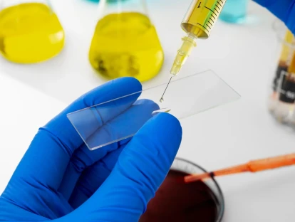 Amvuttra (vutrisirana sódica): para que serve e como obter o medicamento para amiloidose pelo plano de saúde