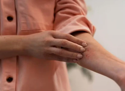 O Globo repercute desafios do tratamento da hidradenite