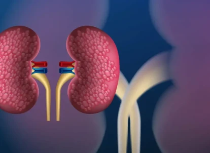 Empaveli (pegcetacoplana): plano de saúde cobre o medicamento?