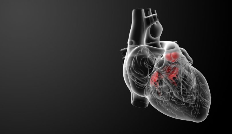 Cirurgica cardíaca TAVI - Plano de saúde deve cobrir cirurgia fora do rol da ANS