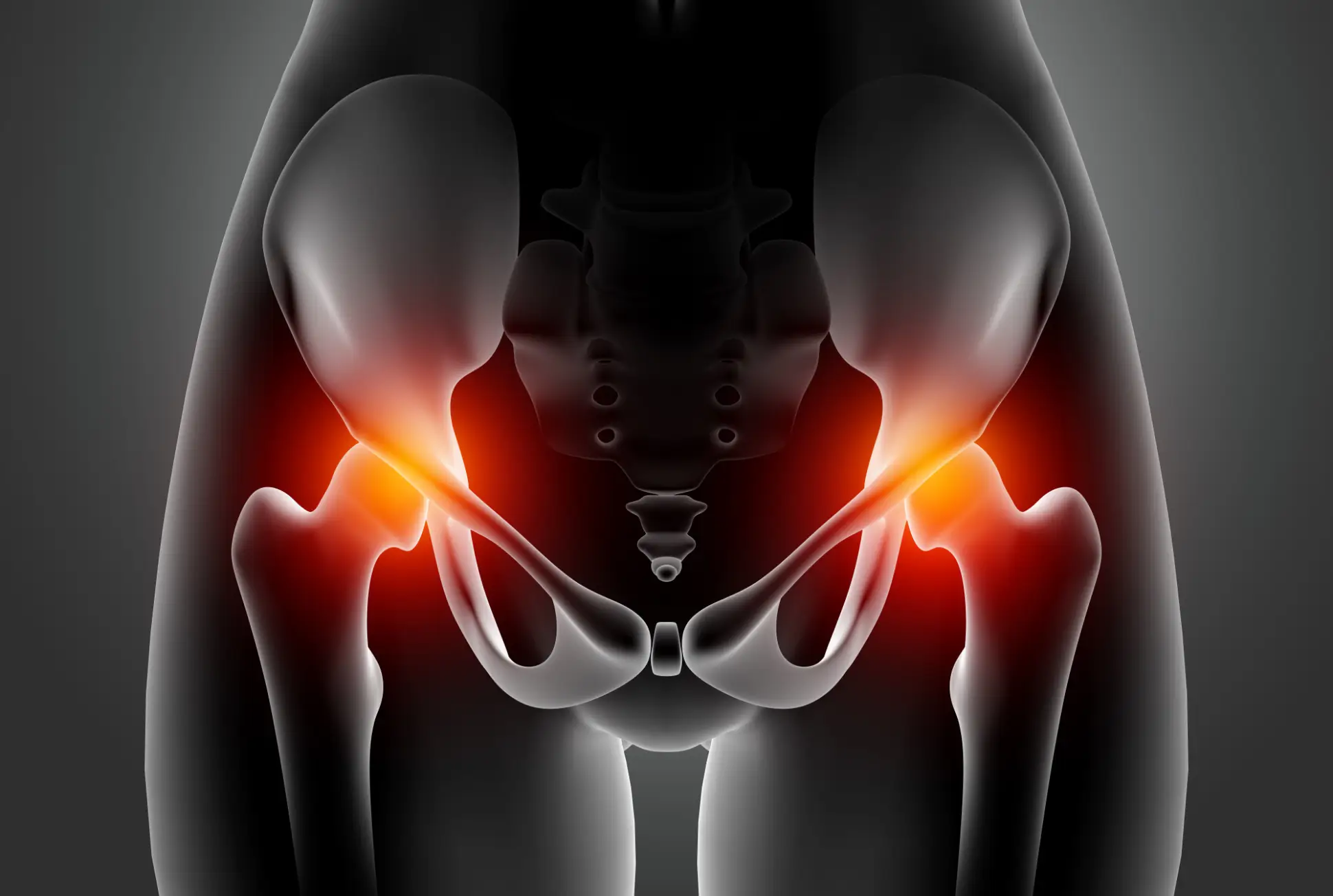 artroplastia de resurfacing para artrose